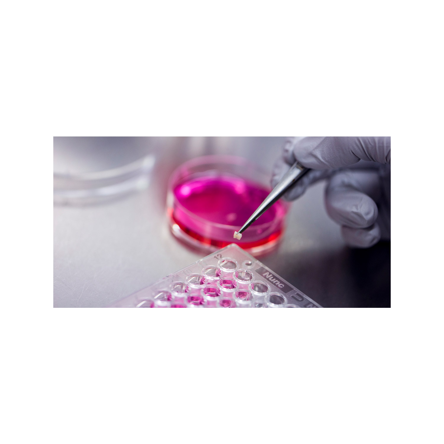 KING-NL-Medische microbiologie